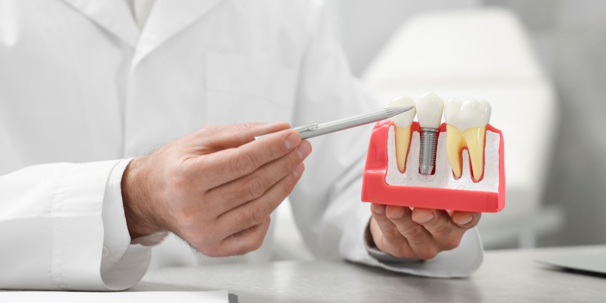 5 Reasons to Choose Dental Implants for Missing Teeth